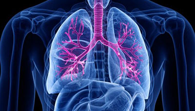 什么是慢性阻塞性肺病 (Chronic Obstructive Pulmonary Disease)，為何與新冠疫情有關(guān)？